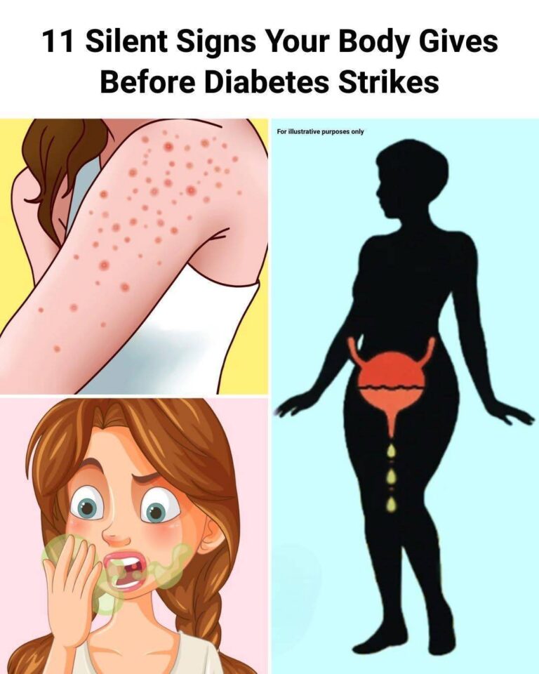 9 Subtle Signs of Diabetes You Might Be Overlooking